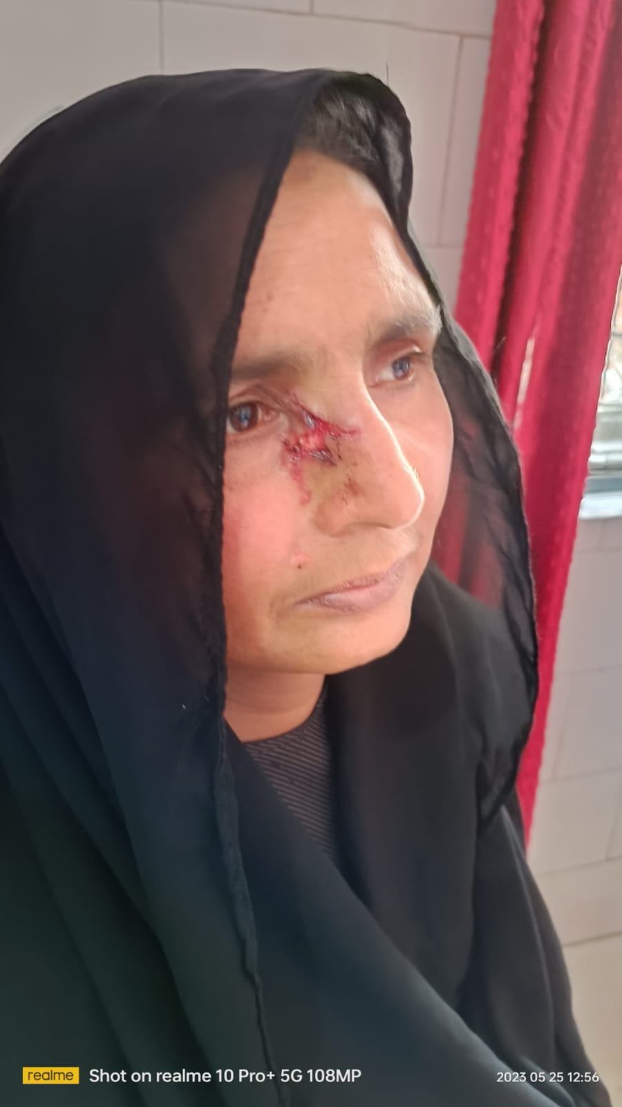 दो पक्षो के बीच चले लाठी डंडों व पथराव में कई घायल