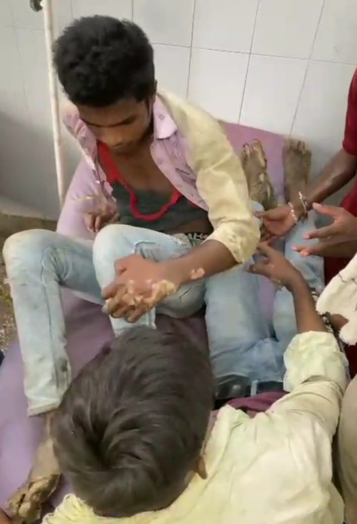 बाबरपुर-अजीतमल क्षेत्र में स्ट्रीट लाइट लगाते समय हुआ हादसा, पांच मजदूर चपेट में