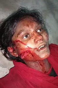 कलियर से आई युवती को धारधार हथियार से वार