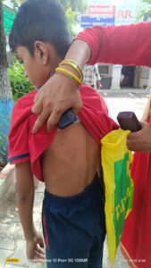 सागर पब्लिक स्कूल की बेरहम शिक्षिका की पिटाई के बाद डरा सहमा छात्र अपनी मां के साथ कोतवाली में