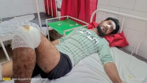 ट्रैक्टर ट्राली ने ई रिक्शा को मारी टक्कर, 5 घायल